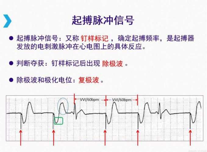 心臟起搏器電路原理如圖